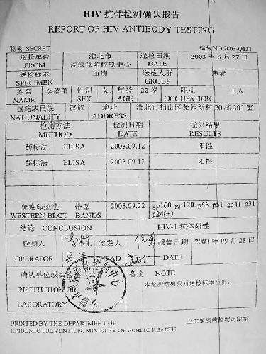 事业单位入职体检中的艾滋病检测，探讨与解析